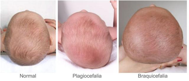 81189-COJIN JANE PLAGIOCEFALIA(16-4)-2